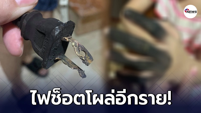 แม่เผยภาพ ลูกน้อยวัย 7 ขวบ เจอปลั๊กบึ้มใส่มือ หลังเสียบปลั๊กพ่วง แม่เผยภาพ ลูกน้อยวัย 7 ขวบ เจอปลั๊กบึ้มใส่มือ หลังเสียบปลั๊กพ่วง