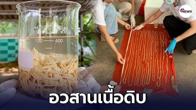 เผยภาพพยาธิตัวตืด 18 เมตร ทุบสถิติยาวสุดในรอบ 50 ปี เผยภาพพยาธิตัวตืด 18 เมตร ทุบสถิติยาวสุดในรอบ 50 ปี