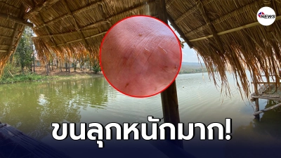 หนุ่มพาครอบครัว ไปเล่นน้ำคลายร้อน เจอสัตว์หน้าตาคล้ายปลิงไต่เต็มเท้า