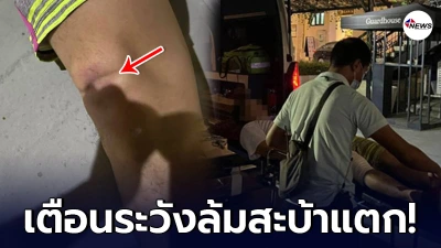 อุทาหรณ์! หนุ่มเล่นเซิร์ฟสเก็ตไร้เซฟตี้ ล้มสะบ้าแตก ค่ารักษาเกือบ 4 แส