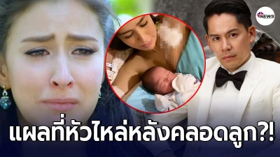 ชาวเน็ตแห่เป็นห่วง ศรีริต้า หลังคลอดลูก แต่กลับมีผ้าพันแผลที่หัวไหล่
