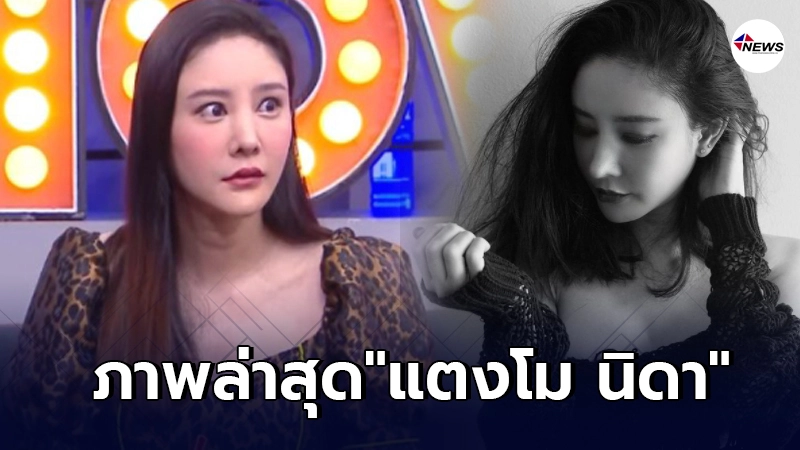 ภาพล่าสุด แตงโม นิดา หลังยอมรับศัลยกรรมทำพิษตัดเส้นประสาทจนคางเบี้ยว ภาพล่าสุด แตงโม นิดา หลังยอมรับศัลยกรรมทำพิษตัดเส้นประสาทจนคางเบี้ยว