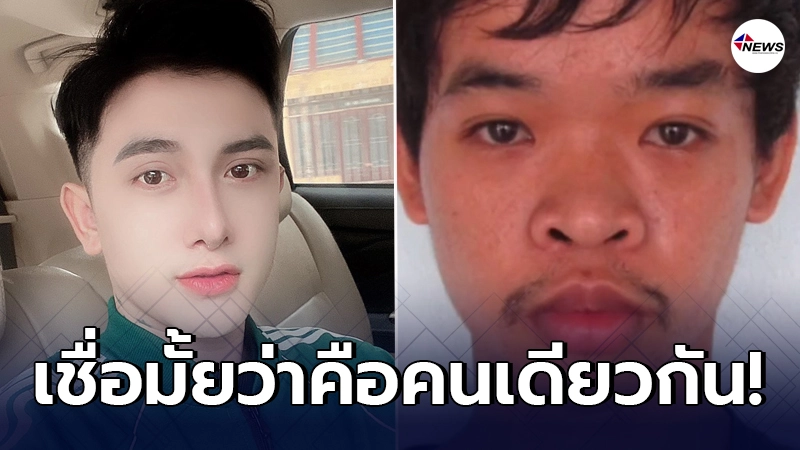 หนุ่มเวียดนามเศร้าหางานทำไม่ได้เพราะหน้าตา ตัดสินใจศัลย์ใหม่หมด
