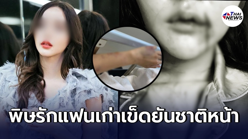 สาวแชร์อุทาหรณ์ เลือกคนรักผิด ชีวิตเหมือนตกนรก ถูกทำร้ายหนัก สาวแชร์อุทาหรณ์ เลือกคนรักผิด ชีวิตเหมือนตกนรก ถูกทำร้ายหนัก