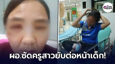 ผอ.โหด ดื่มได้ที่หลังงานกีฬาสี อารมณ์ขึ้น ซัดหน้าครูสาวยับ ผอ.โหด ดื่มได้ที่หลังงานกีฬาสี อารมณ์ขึ้น ซัดหน้าครูสาวยับ