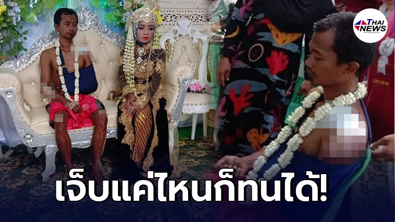 หนุ่มอินโด หลังประสบอุบัติเหตุ ไม่ทิ้งหน้าที่เจ้าบ่าว มาเข้าพิธีแต่งงาน