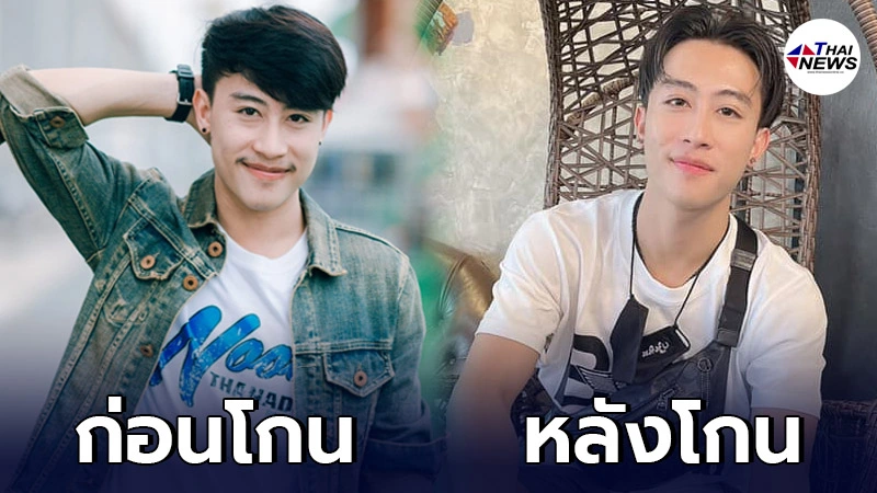 เผยภาพ "นุ๊ก ธนดล" หลังโกนหนวดเกลี้ยงในรอบ 3 ปี เปลี่ยนไปมาก จนแฟนๆ คอมเมนต์กันสนั่น เผยภาพ "นุ๊ก ธนดล" หลังโกนหนวดเกลี้ยงในรอบ 3 ปี เปลี่ยนไปมาก จนแฟนๆ คอมเมนต์กันสนั่น
