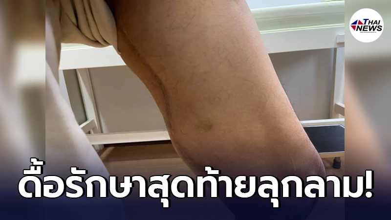 ลุงตำรวจป่วยมะเร็งไม่ยอมรักษา ก่อนหวังพึ่งหมอเป่าช่วย แต่ไม่เป็นผล