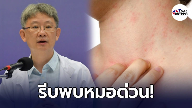 เผยอาการโควิดรูปแบบใหม่ ไม่มีไข้ ตาแดง ผื่นขึ้น หากเป็นรีบตรวจหาเชื้อด่วน! เผยอาการโควิดรูปแบบใหม่ ไม่มีไข้ ตาแดง ผื่นขึ้น หากเป็นรีบตรวจหาเชื้อด่วน!