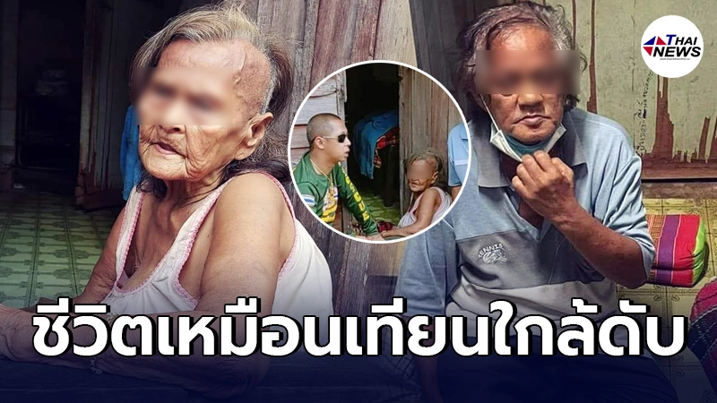 บั้นปลายชีวิต 2 แม่ลูก เหมือนแสงเทียนใกล้ดับ วอนผู้ใจบุญมองเห็น บั้นปลายชีวิต 2 แม่ลูก เหมือนแสงเทียนใกล้ดับ วอนผู้ใจบุญมองเห็น