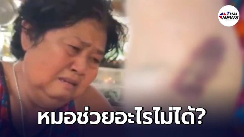 อสม. เกิดอาการแพ้วัคซีนซิโนแวค ตอนนี้แขน-ขา ไร้ความรู้สึก