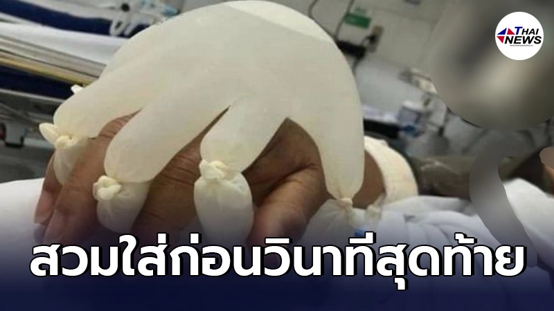 เปิดสาเหตุ ผู้ป่วยห้อง ICU ในต่างประเทศ พอใกล้ถึงวาระสุดท้าย