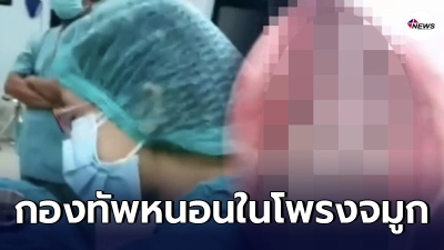 คนไข้ 66 ปีเลือดกำเดาไหลทุก 3 วันมาหาหมอส่องกล้องเจอหนอนในโพรงจมูก