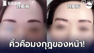 สาวจีนอยากสวย จ่ายเงินเกือบ 3 แสน สักคิ้วถาวร สุดท้ายออกมาสุดชุ่ย สาวจีนอยากสวย จ่ายเงินเกือบ 3 แสน สักคิ้วถาวร สุดท้ายออกมาสุดชุ่ย