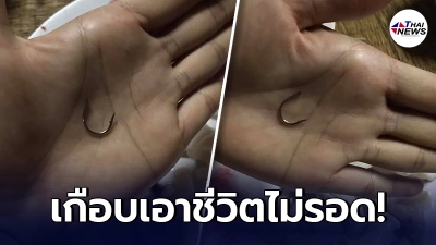 สาวเตือนภัย ซื้อหนวดปลาหมึกมากิน กัดไปเจอก้อนแข็งๆ คล้ายตะขอเบ็ด สาวเตือนภัย ซื้อหนวดปลาหมึกมากิน กัดไปเจอก้อนแข็งๆ คล้ายตะขอเบ็ด
