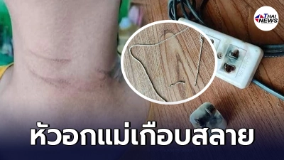อุทาหรณ์ ชาร์จแบตมือถือบนที่นอน สร้อยคอโดนปลั๊ก ไฟช็อตคอเป็นรอยไหม้