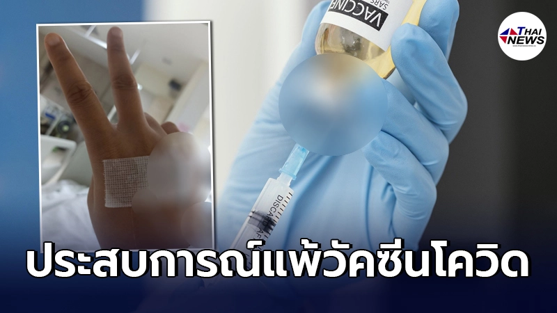 สาวแชร์ประสบการณ์ วินาทีแพ้วัคซีนโควิด-19 เกือบเอาชีวิตไม่รอด