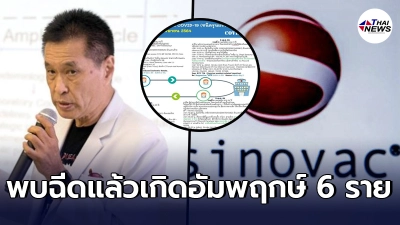 หมอธีระวัฒน์ เผย พบ ปชช. ฉีดวัคซีนซิโนแวค เกิดอัมพฤกษ์ 6 ราย หมอธีระวัฒน์ เผย พบ ปชช. ฉีดวัคซีนซิโนแวค เกิดอัมพฤกษ์ 6 ราย