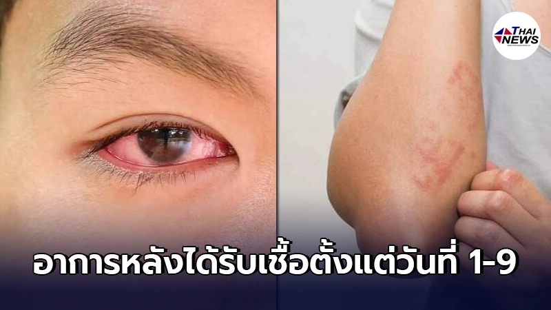 เปิดสัญญาณ ตั้งแต่วันที่ 1-9 อาการหลังได้รับเชื้อ โควิด-19 เข้าสู่ร่างกาย เปิดสัญญาณ ตั้งแต่วันที่ 1-9 อาการหลังได้รับเชื้อ โควิด-19 เข้าสู่ร่างกาย