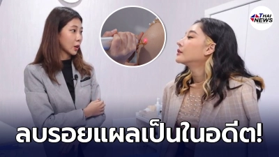 "คลินิกดัง" เคลียร์ปม "แตงโม นิดา" ขอลบรอยแผลเป็นในอดีตอุบัติเหตุรถคว่ำ