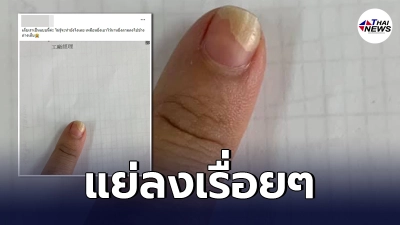 สาวเผชิญปัญหา เล็บกินนิ้ว ปล่อยไว้นานวัน กลับยิ่งแย่ลงเรื่อยๆ