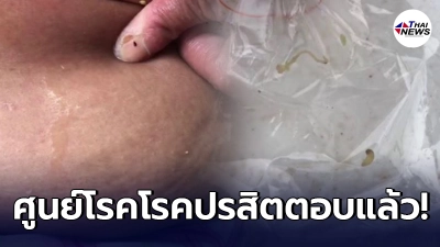ศูนย์วิจัยโรคปรสิตตอบเรื่องโรคประหลาดของคุณป้าอ้างมีหนอนไชจากผิวหนัง