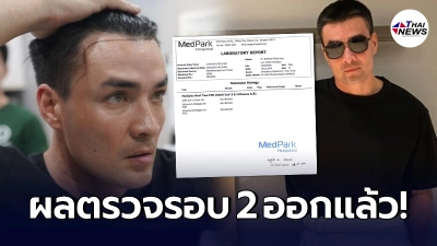 ออกแล้ว! ผลตรวจโควิด-19 รอบ 2 ตั๊ก บริบูรณ์ หลังผู้ใกล้ชิดทุกคนมีผลเป็นบวก