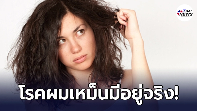 "โรคผมเหม็น"มีอยู่จริง หลายคนไม่เคยรู้ แถมกำลังเป็นอยู่ด้วย