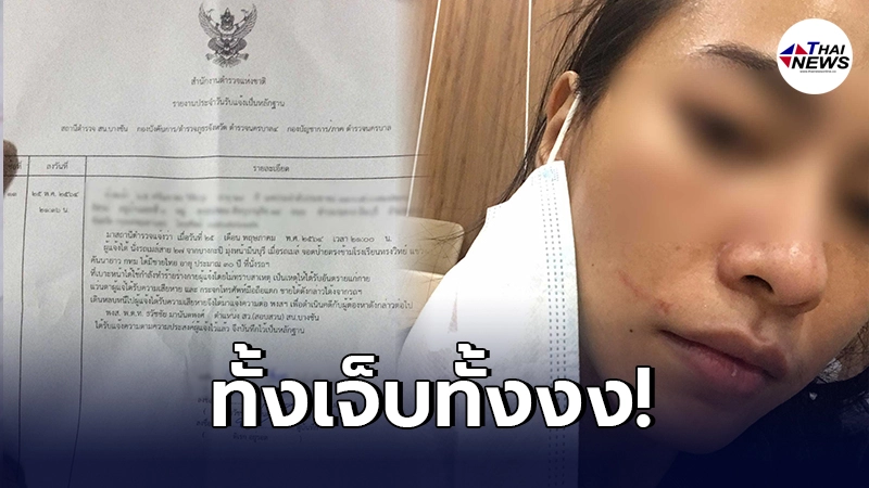 ตำรวจเร่งล่าตัว สาวถูกชายแปลกหน้า ต่อยบนรถเมล์ไม่ยั้ง หลังเข่าโดนเบาะ ตำรวจเร่งล่าตัว สาวถูกชายแปลกหน้า ต่อยบนรถเมล์ไม่ยั้ง หลังเข่าโดนเบาะ