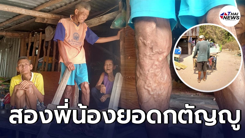 สองพี่น้องพิการทางสมอง สู้เพื่อแม่ เดินทาง 30 กิโล เข็นรถเก็บขยะ สองพี่น้องพิการทางสมอง สู้เพื่อแม่ เดินทาง 30 กิโล เข็นรถเก็บขยะ