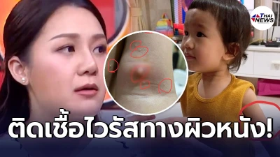 หัวอกแม่ เอ็ม บุษราคัม เจ็บปวดหัวใจ หลังลูกสาว น้องณเวฬา เป็นโรคหูดข้าวสุก