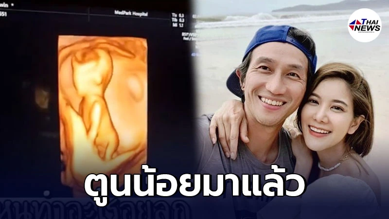ก้อย-พี่ตูน เฉลยแล้ว 1+1 = 3 ท้องลูกคนแรก แฟนคลับพากันแห่ยินดี