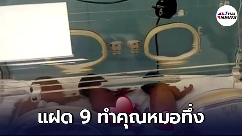 แม่คลอดลูกรวดเดียว แฝด 9 ทำคุณหมอทึ่ง หลังนับได้แค่ 7 ก่อนตัดสินใจผ่าคลอด แม่คลอดลูกรวดเดียว แฝด 9 ทำคุณหมอทึ่ง หลังนับได้แค่ 7 ก่อนตัดสินใจผ่าคลอด