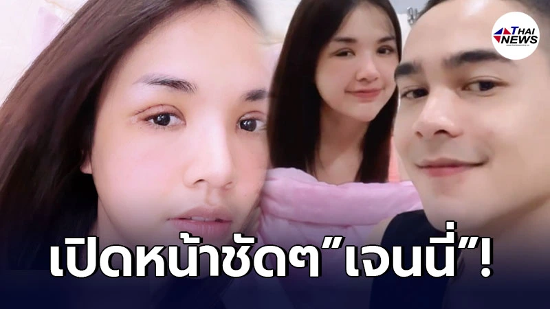 เปิดหน้าชัดๆ เจนนี่ ได้หมดถ้าสดชื่น หลังทำตา2ชั้น ยิว ดูแลไม่ห่าง เปิดหน้าชัดๆ เจนนี่ ได้หมดถ้าสดชื่น หลังทำตา2ชั้น ยิว ดูแลไม่ห่าง