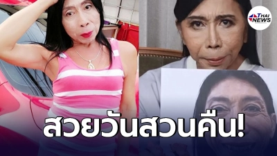 สิตางศุ์ บัวทอง เผยภาพล่าสุด หลังทำศัลยกรรม เสริมจมูก ชาวเน็ตชมสวยขึ้นมาก