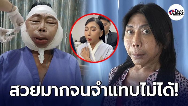 ภาพล่าสุด สิตางศุ์ บัวทอง หลังทำศัลยกรรม ทุบใหม่ทั้งหน้า สวยจนจำแทบไม่ได้