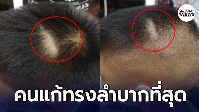 ช่างตัดผม ขอครูเห็นใจ ไม่ใช่นึกจะกล้อนผมนักเรียน เท่าไหร่ก็ได้ ชี้คนแก้ ช่างตัดผม ขอครูเห็นใจ ไม่ใช่นึกจะกล้อนผมนักเรียน เท่าไหร่ก็ได้ ชี้คนแก้