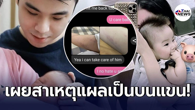 สามีชาวฮ่องกง เผยสาเหตุ “รอยแผลเป็นที่แขน” น้ำตาล หวั่นถูกอดีตเมียใส่ร้าย สามีชาวฮ่องกง เผยสาเหตุ “รอยแผลเป็นที่แขน” น้ำตาล หวั่นถูกอดีตเมียใส่ร้าย