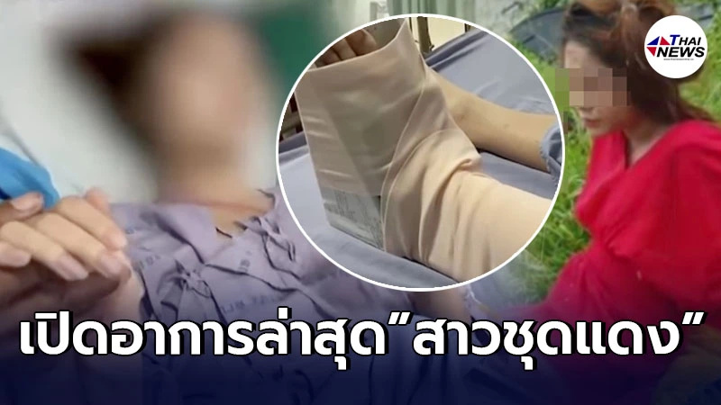 เปิดอาการล่าสุด “สาวชุดแดง” หลัง "เสี่ยบีเอ็ม" พาเหินข้ามเลน จนขาหักผิดรูป เปิดอาการล่าสุด “สาวชุดแดง” หลัง "เสี่ยบีเอ็ม" พาเหินข้ามเลน จนขาหักผิดรูป