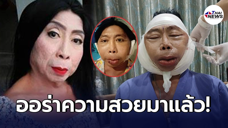 เปิดภาพล่าสุด แม่สิตางศุ์ หลังทำศัลยกรรมวันแรก ออร่าความสวยมาแล้ว เปิดภาพล่าสุด แม่สิตางศุ์ หลังทำศัลยกรรมวันแรก ออร่าความสวยมาแล้ว