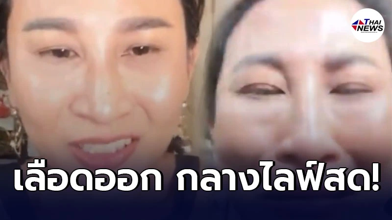 ชาวเน็ตแห่เป็นห่วง ลาล่า อาร์สยาม หลังเลือดออกขณะไลฟ์ หาเงินเลี้ยงปากท้อง ชาวเน็ตแห่เป็นห่วง ลาล่า อาร์สยาม หลังเลือดออกขณะไลฟ์ หาเงินเลี้ยงปากท้อง