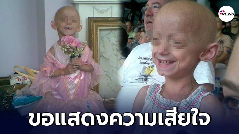 สาวป่วยแปลก แก่ตั้งแต่เด็ก เสียชีวิตหลังฉลองวันเกิดครบรอบ 18ปี สาวป่วยแปลก แก่ตั้งแต่เด็ก เสียชีวิตหลังฉลองวันเกิดครบรอบ 18ปี