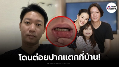 "จิน" สามี "หนิง ปณิตา" เล่าเหตุการณ์อยู่บ้านเฉยๆแต่กลับโดนต่อยปากแตก