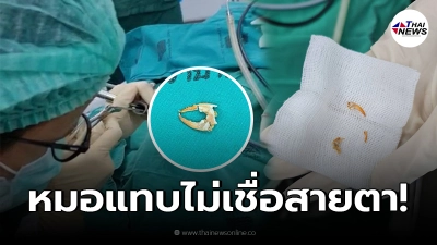 เตือนอุทาหรณ์ ผู้สูงอายุวัย 70 ซดขนมจีนน้ำยาปู น้ำลายฟูมปาก-หายใจไม่ออก เตือนอุทาหรณ์ ผู้สูงอายุวัย 70 ซดขนมจีนน้ำยาปู น้ำลายฟูมปาก-หายใจไม่ออก
