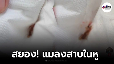สาวปวดหูกลางดึก ตัดสินใจไปหาหมอ ผงะ เจอแมลงสาบในรูหู โดนคีบออกมายังดิ้นสู้ สาวปวดหูกลางดึก ตัดสินใจไปหาหมอ ผงะ เจอแมลงสาบในรูหู โดนคีบออกมายังดิ้นสู้