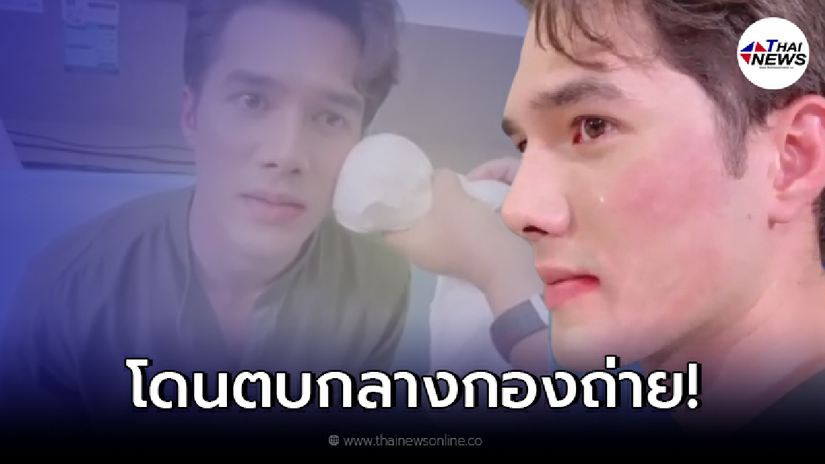"มิกค์ ทองระย้า" โดนนางเอกตบกลางกองถ่ายจนหน้าบวม "หนิง ปณิตา" ยังตกใจ "มิกค์ ทองระย้า" โดนนางเอกตบกลางกองถ่ายจนหน้าบวม "หนิง ปณิตา" ยังตกใจ