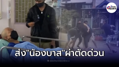 บาส หนุ่มลุยเดี่ยว เข้าผ่าตัดด่วน หมอปลาเผย พบกระดูกหัก หวั่นแผลลามติดเชื้อ บาส หนุ่มลุยเดี่ยว เข้าผ่าตัดด่วน หมอปลาเผย พบกระดูกหัก หวั่นแผลลามติดเชื้อ