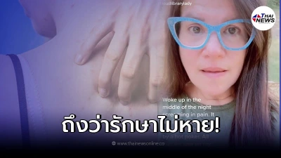 สาวคันหลัง นึกว่าสิว ทนเจ็บปวดมานาน 2 เดือน กลับกลายเป็นเรื่องน่ากลัว
