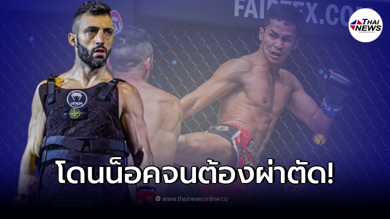 คู่แข่ง ซุปเปอร์บอน ต้องผ่าตัดด่วน หลังพลาดท่าเสียแชมป์ให้นักชกชาวไทย คู่แข่ง ซุปเปอร์บอน ต้องผ่าตัดด่วน หลังพลาดท่าเสียแชมป์ให้นักชกชาวไทย