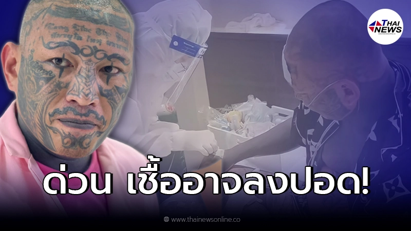 ด่วน “เก่ง ลายพราง”  เชื้ออาจลงปอด  ต้องอยู่ในความดูแลแพทย์ใกล้ชิด!